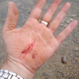 Owie, I Had Fun!